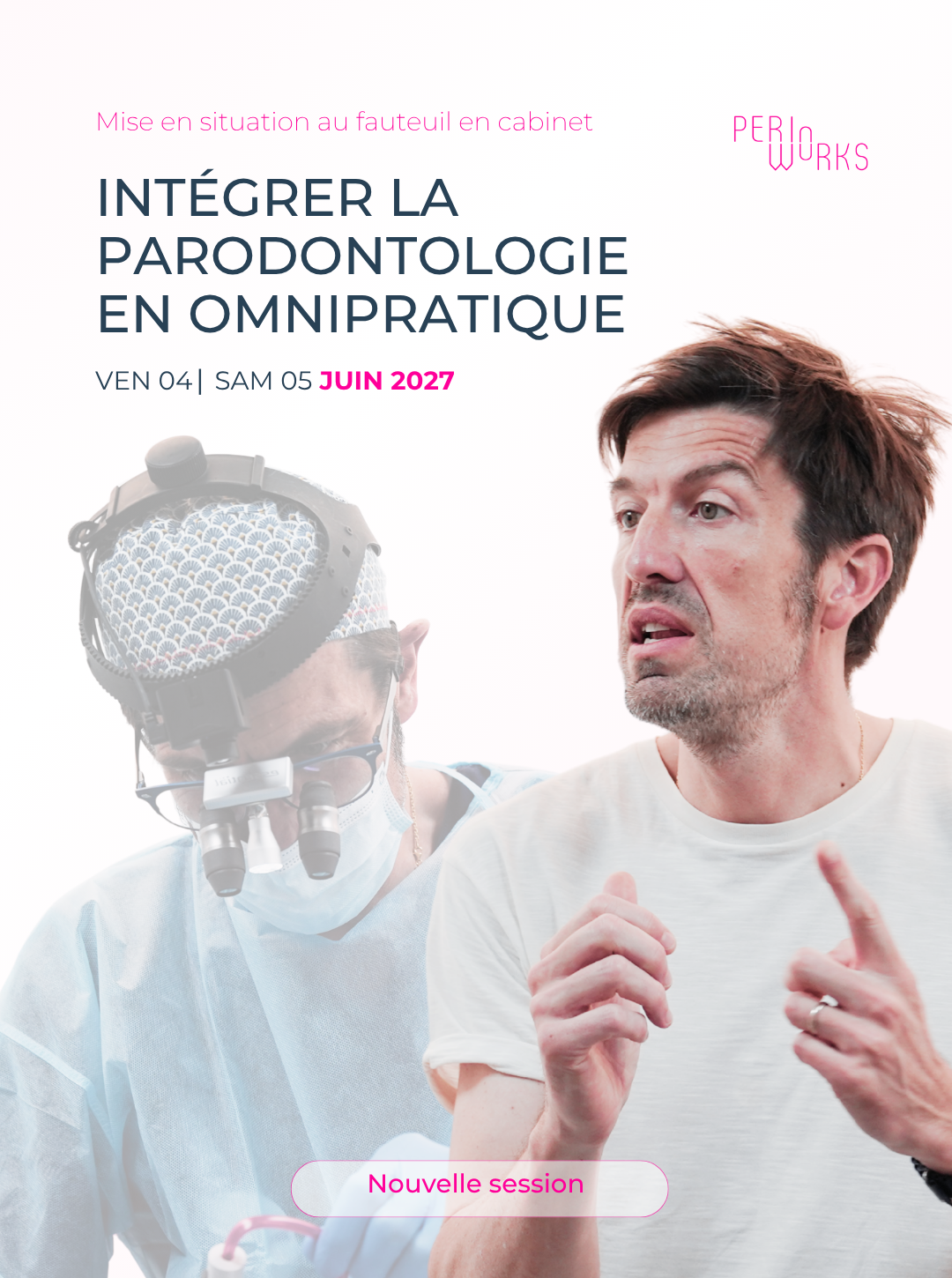 Avant/Après