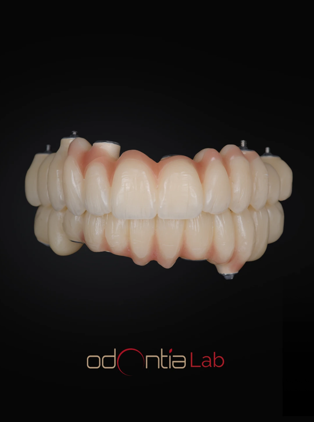 Prothèse dentaire Odontia Lab